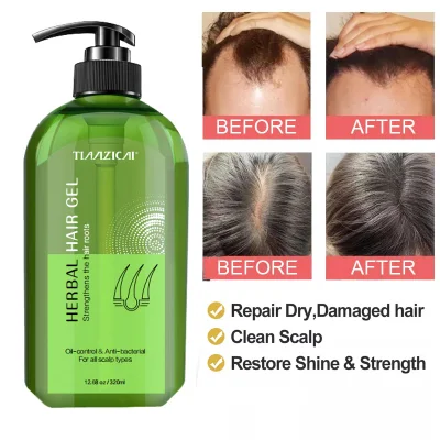 Haarpflege, feuchtigkeitsspendendes Haarshampoo, Anti-Haarausfall-Shampoo für das Nachwachsen der Haare, Shampoo-Seife